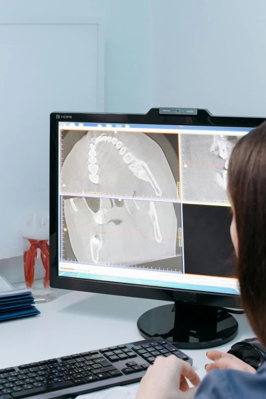 woman working on computer screen with images coming out of a large x - ray