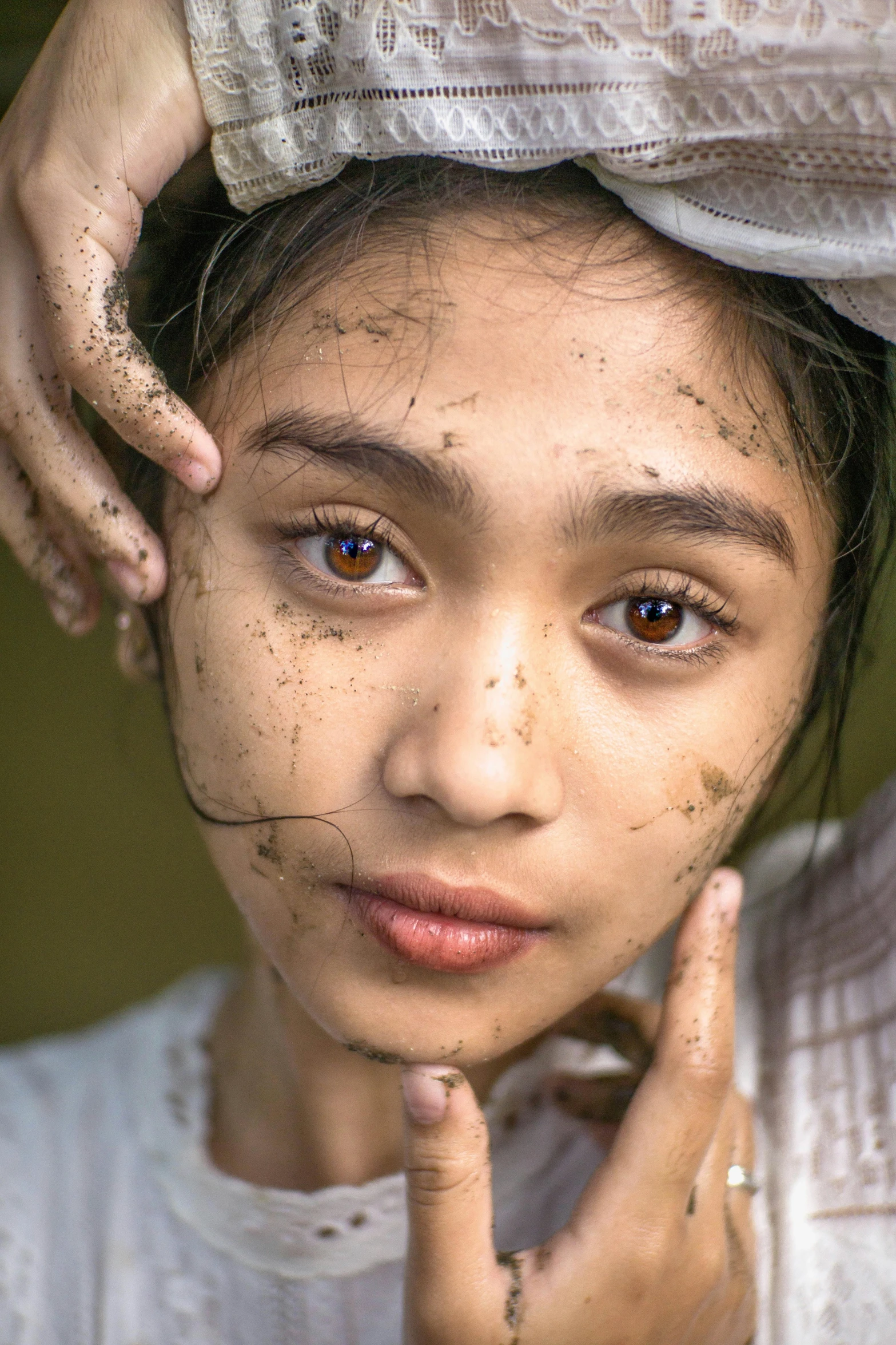 a girl has freckled over her forehead as she poses for the camera