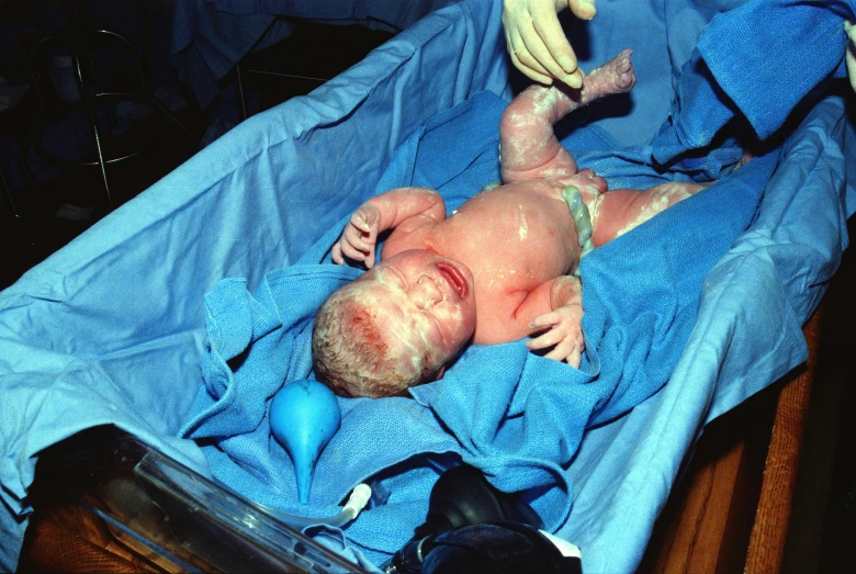 an image of an infant being treated in the hospital