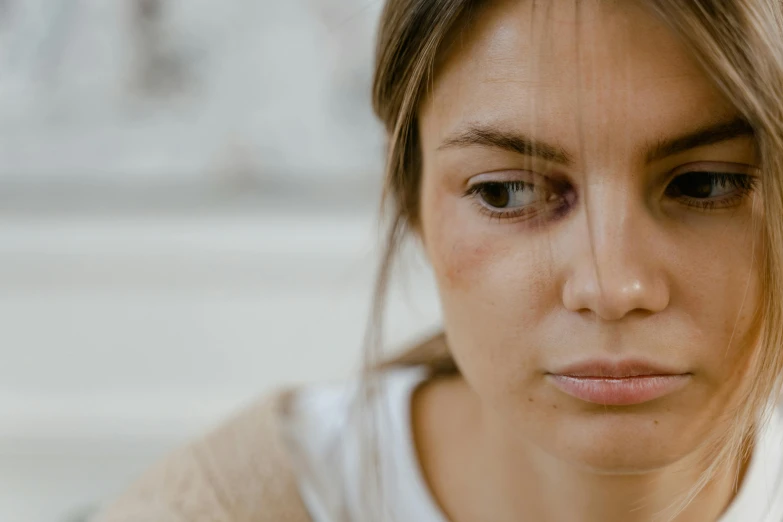 a woman with black marks on her face