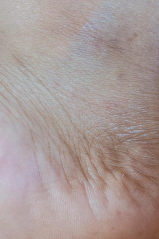 close up po of a persons skin with only the skin visible