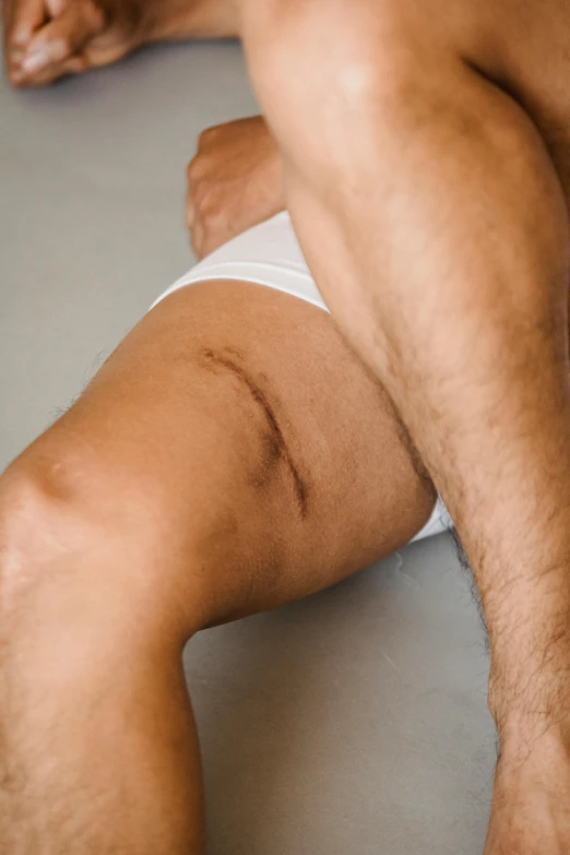 a male legs in briefs with a brown spot on it