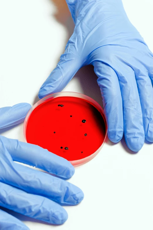 gloved hands are picking up a petri dish containing a lot of red stuff