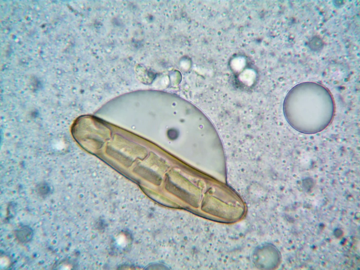 an animal cell, the body and legs is visible