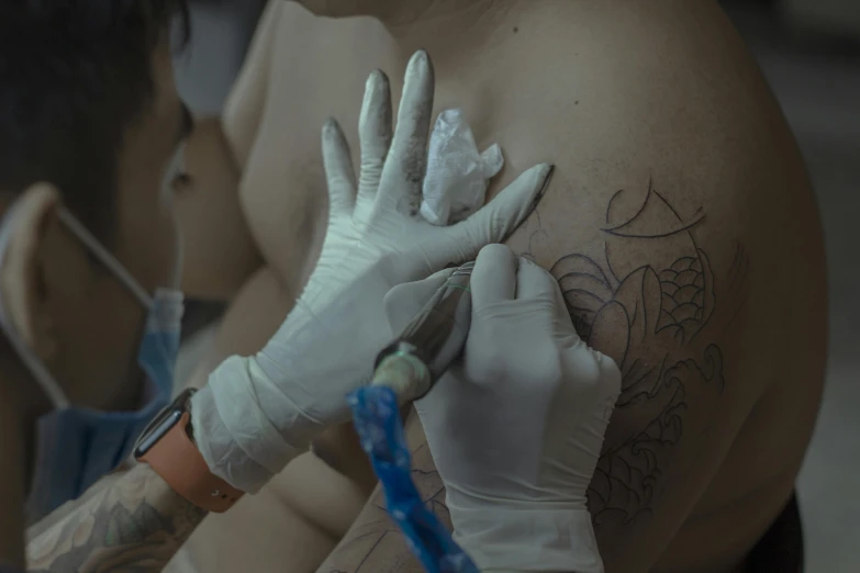 the doctor is painting the right side of a patient's upper arm