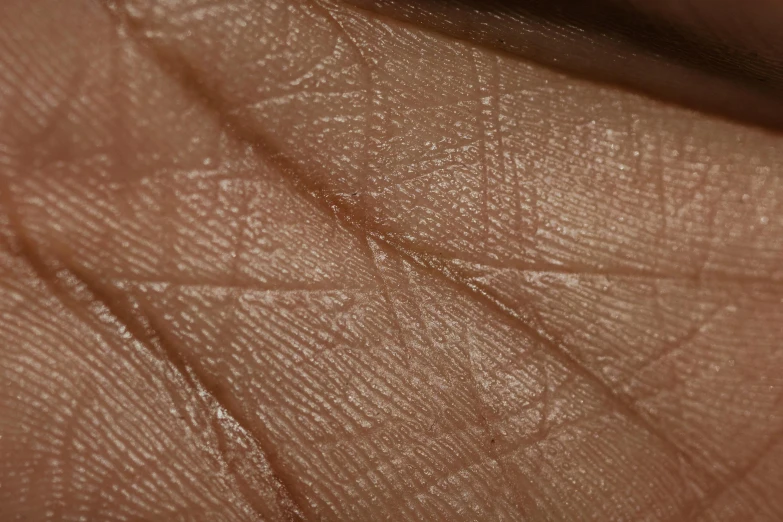 closeup of an area of the skin that appears to be in someone's hand