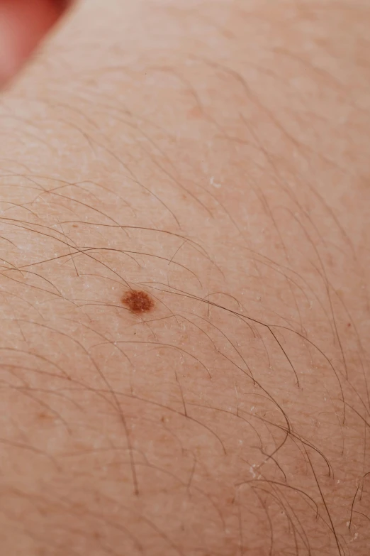 some hair that is very close up in a person's chest