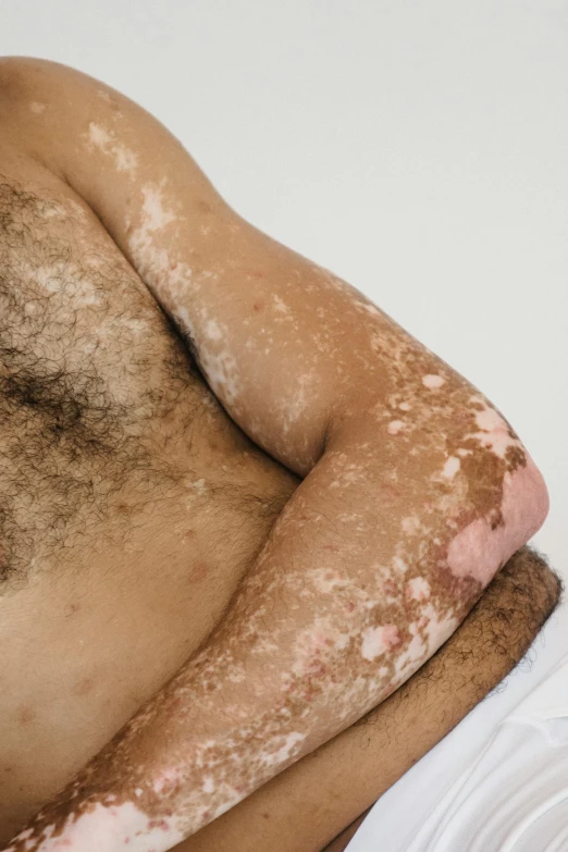 a hairy man with spots all over his chest