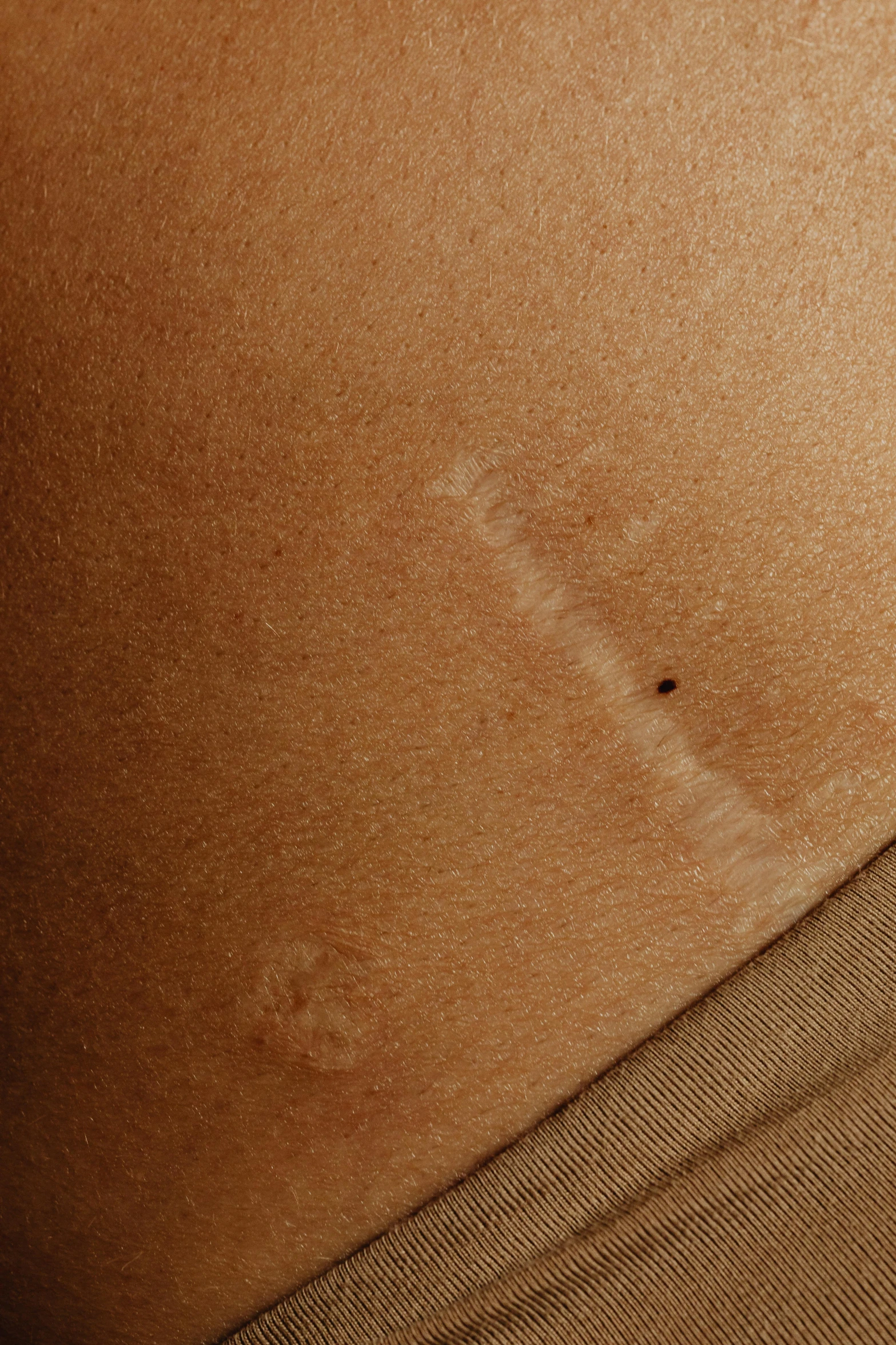 the bottom of someone's stomach showing rust on it