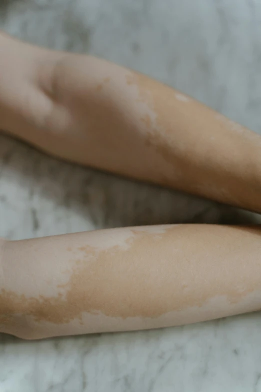 the back of a woman with freckled hands