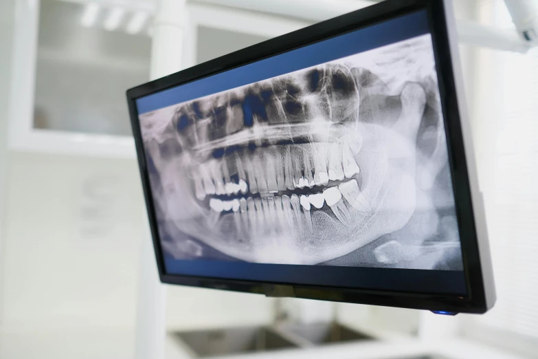 a computer monitor with a tooth and smile on it