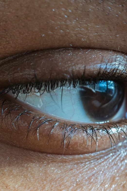 an eye with long eyelashes and a blue ring