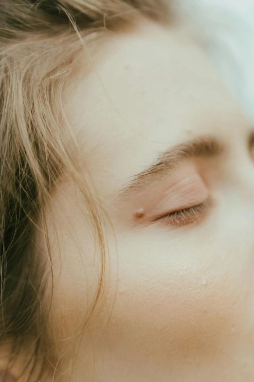 the woman has a brown spot in her face