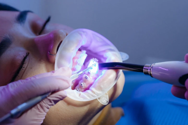 the teeth of a girl having their teeth brushed