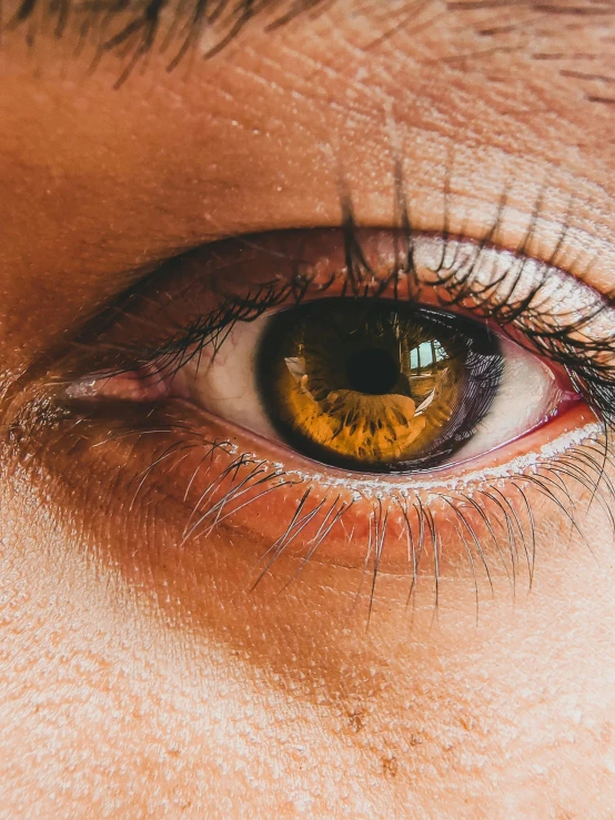 a close up of a persons eye showing the structure of their iris