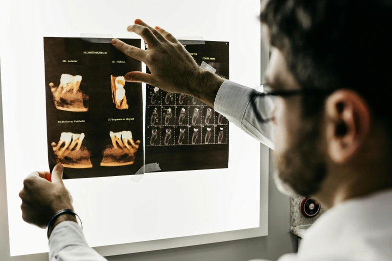 a man pointing to x - ray images in front of a monitor