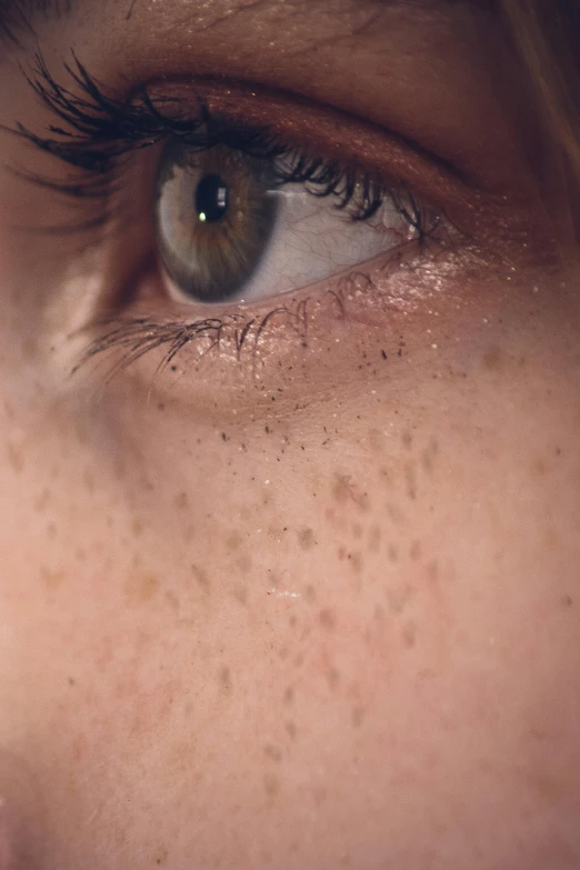 the eye of a woman with freckles on her body