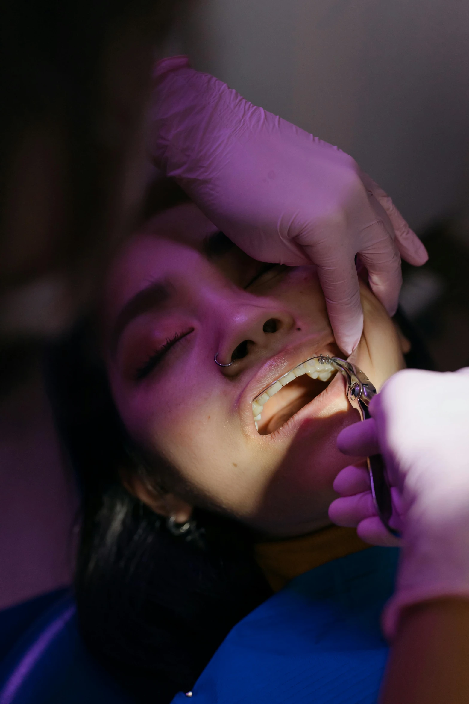 a person with gloves on gets their teeth brushed