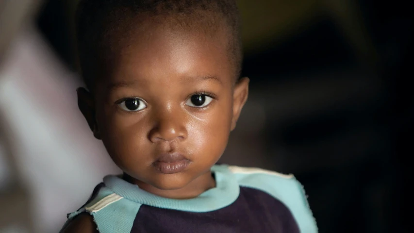 a little boy with no hair is staring into the camera