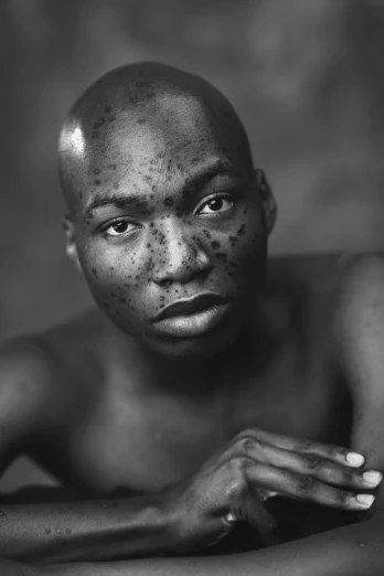 an african man looks at the camera while wearing dirty skin