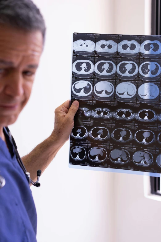 a male doctor looking at some mri images