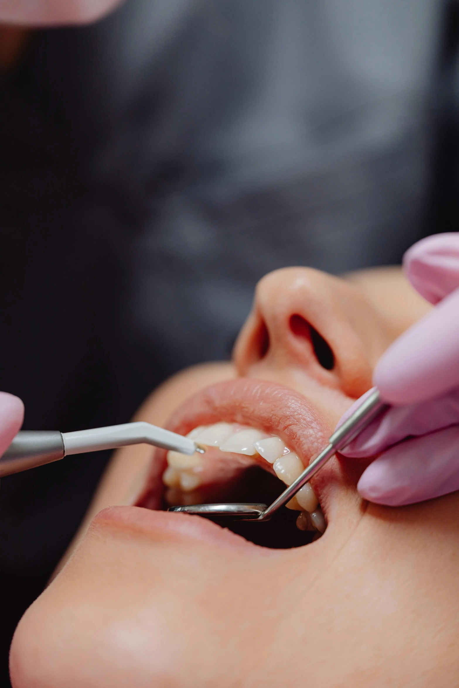 dentist at procedure on female's teeth with open mouth