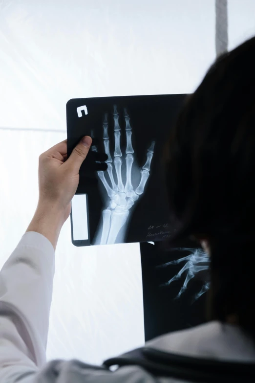 a person with a radio x - ray showing a hand