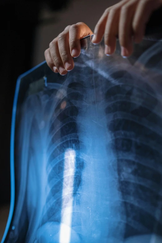 the back of a person holding an x - ray to the chest