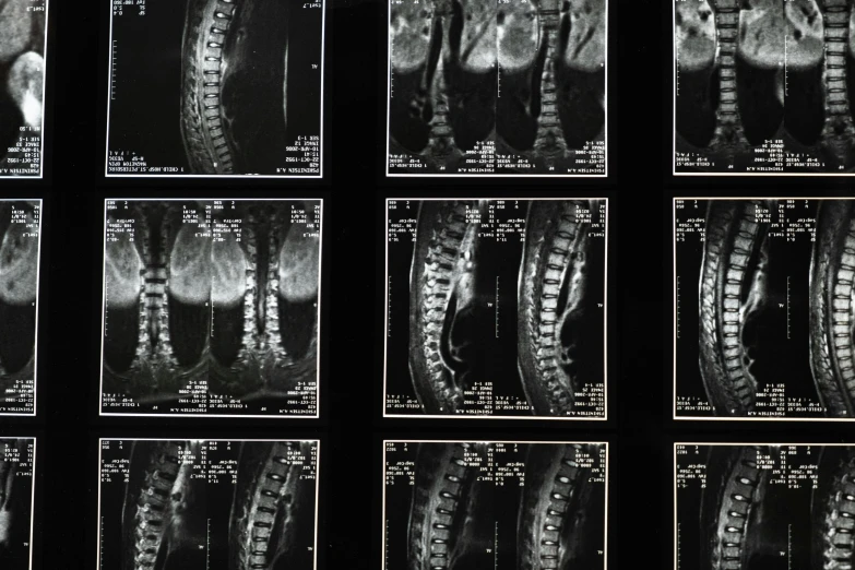 x - ray images show several different angles of a bicycle tire