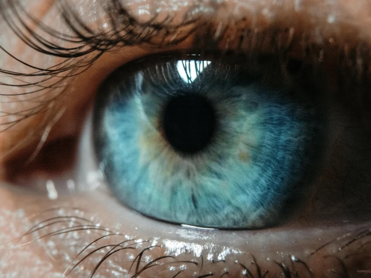 a close up of a blue eye and a small spot in the iris