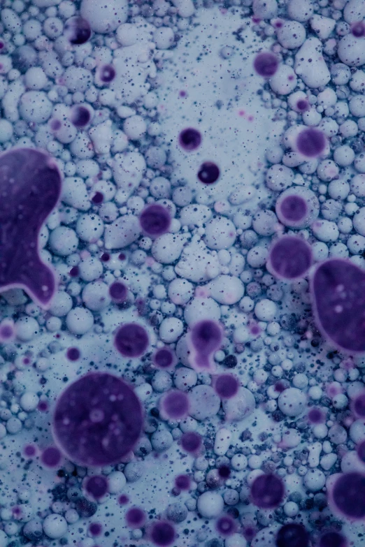 some purple and white  cells in a vein