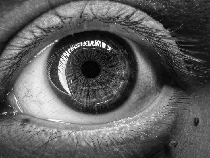 close up of a man's eye with an unkempt iris