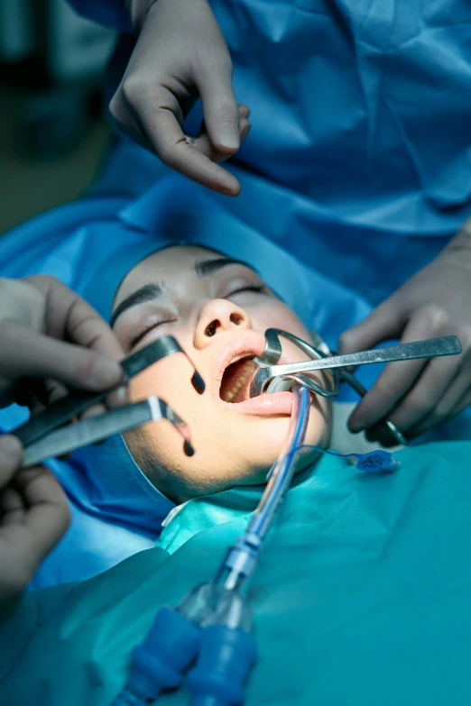 a dentist holds a pair of scissors to open the mouth