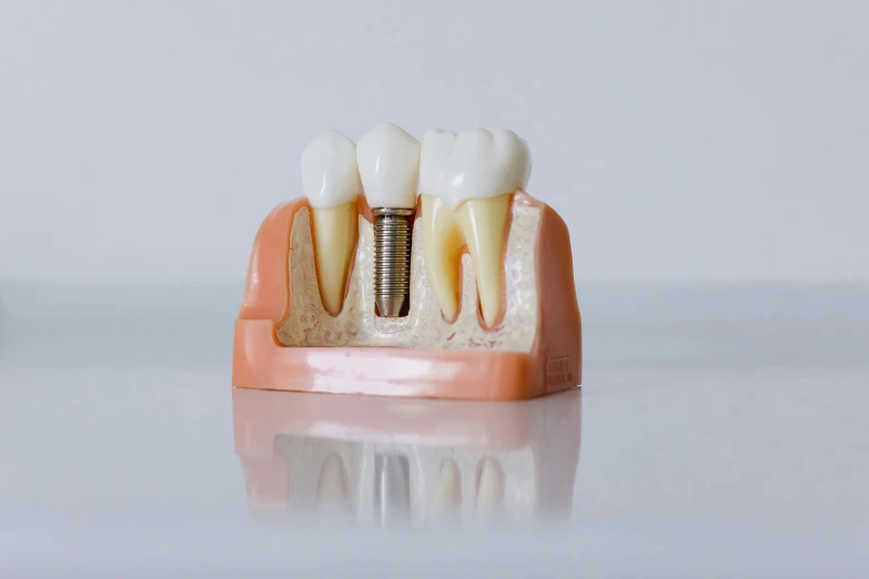 a dental model with four pieces of teeth on it