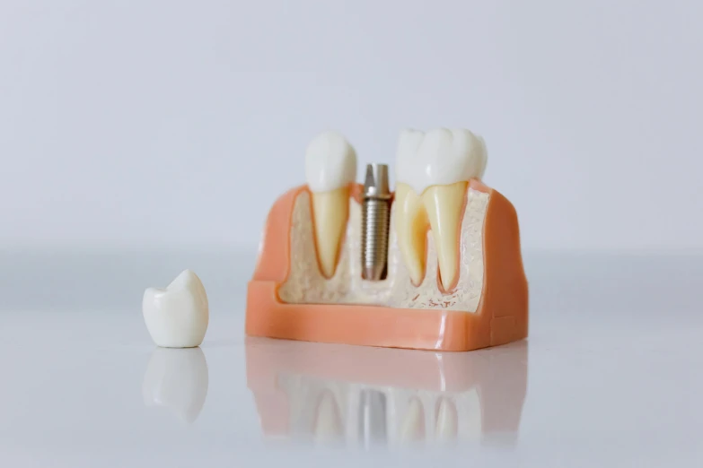 a pair of tooth implants are arranged on a surface