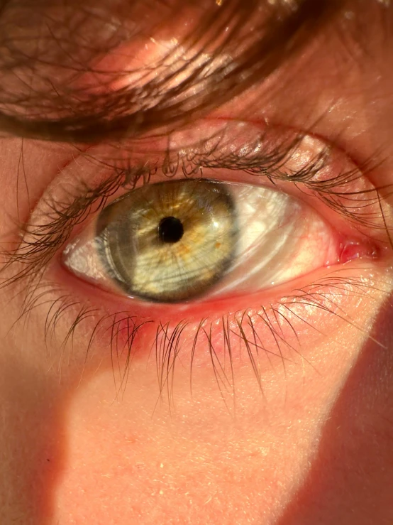 a persons eyes with a black dot on the iris