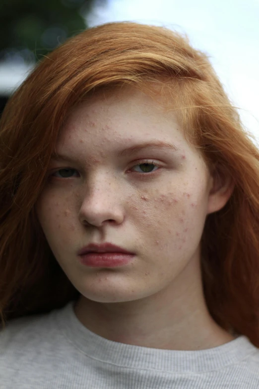 a close up of a girl with freckles on her hair