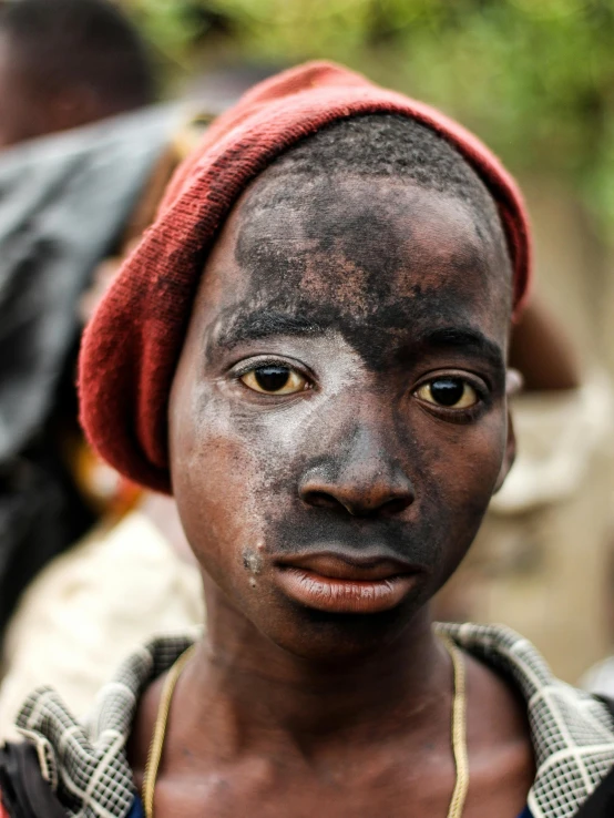 a girl has black facial powder on her face