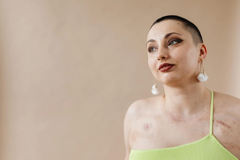 a young woman poses in a yellow halter top