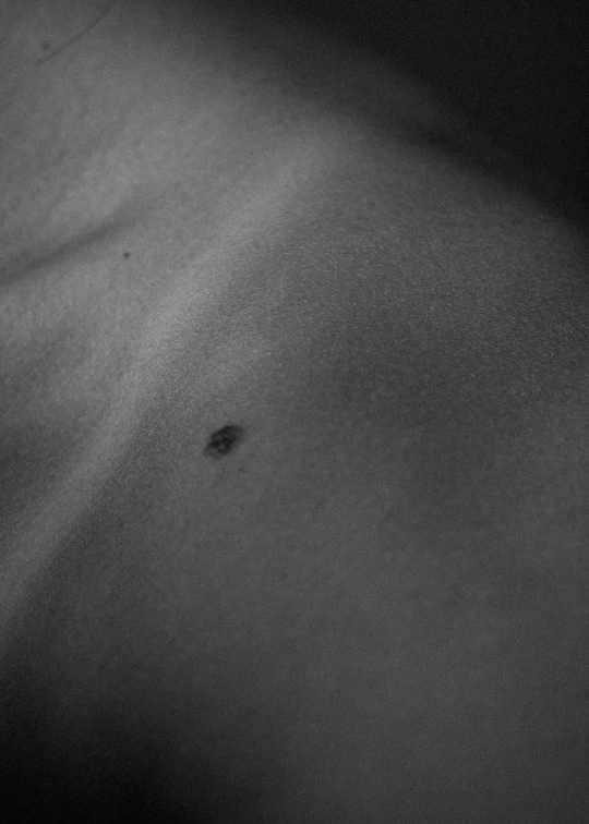 black and white pograph of the skin of a person
