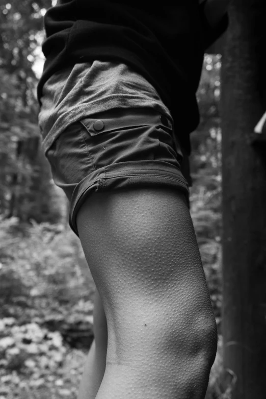 the arm of a man wearing short shorts