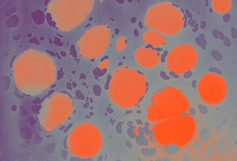 a picture showing  vessels with orange spots