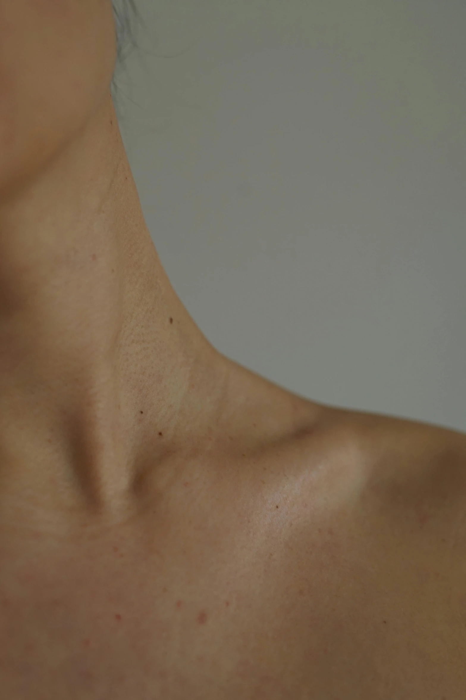 a woman showing her back and neck with very small, flat acne