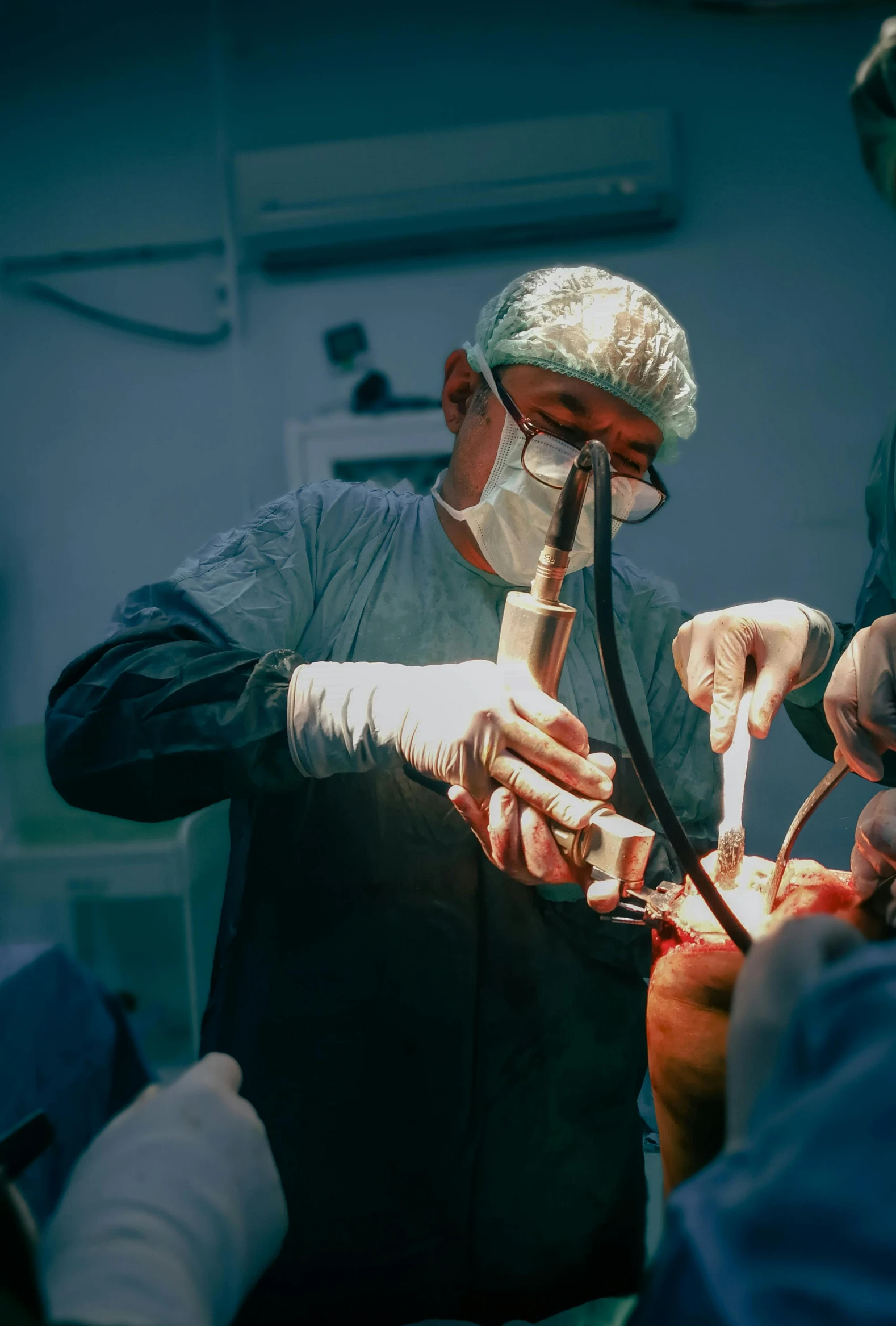 three surgeons performing  in an operating room