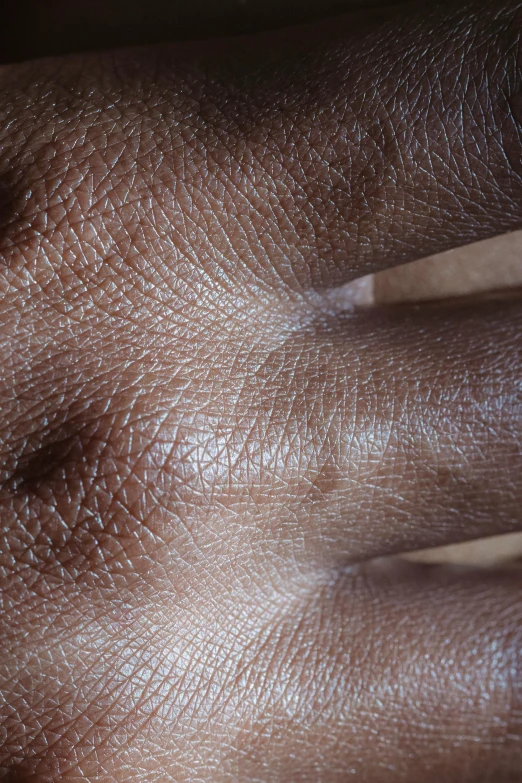 the inside of a human body's skin with brown streaks