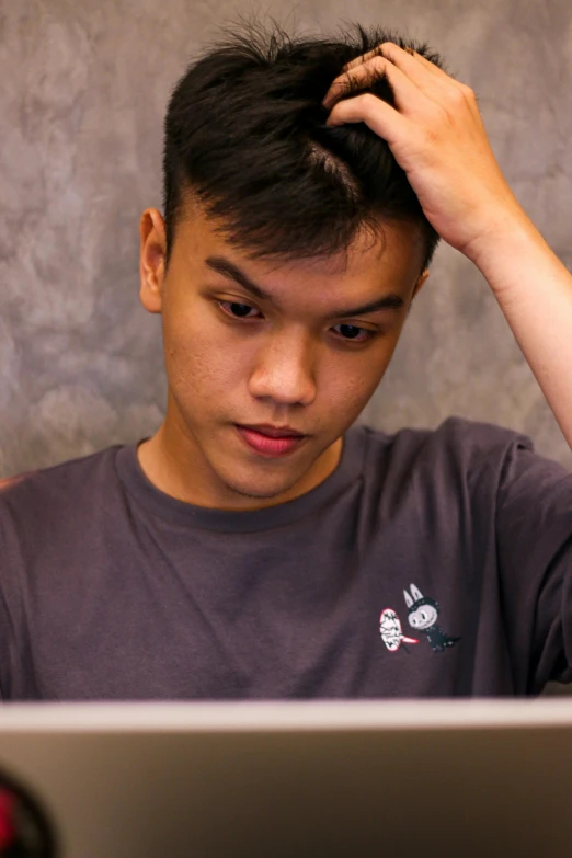 a young man who has hair loss stares down from a laptop