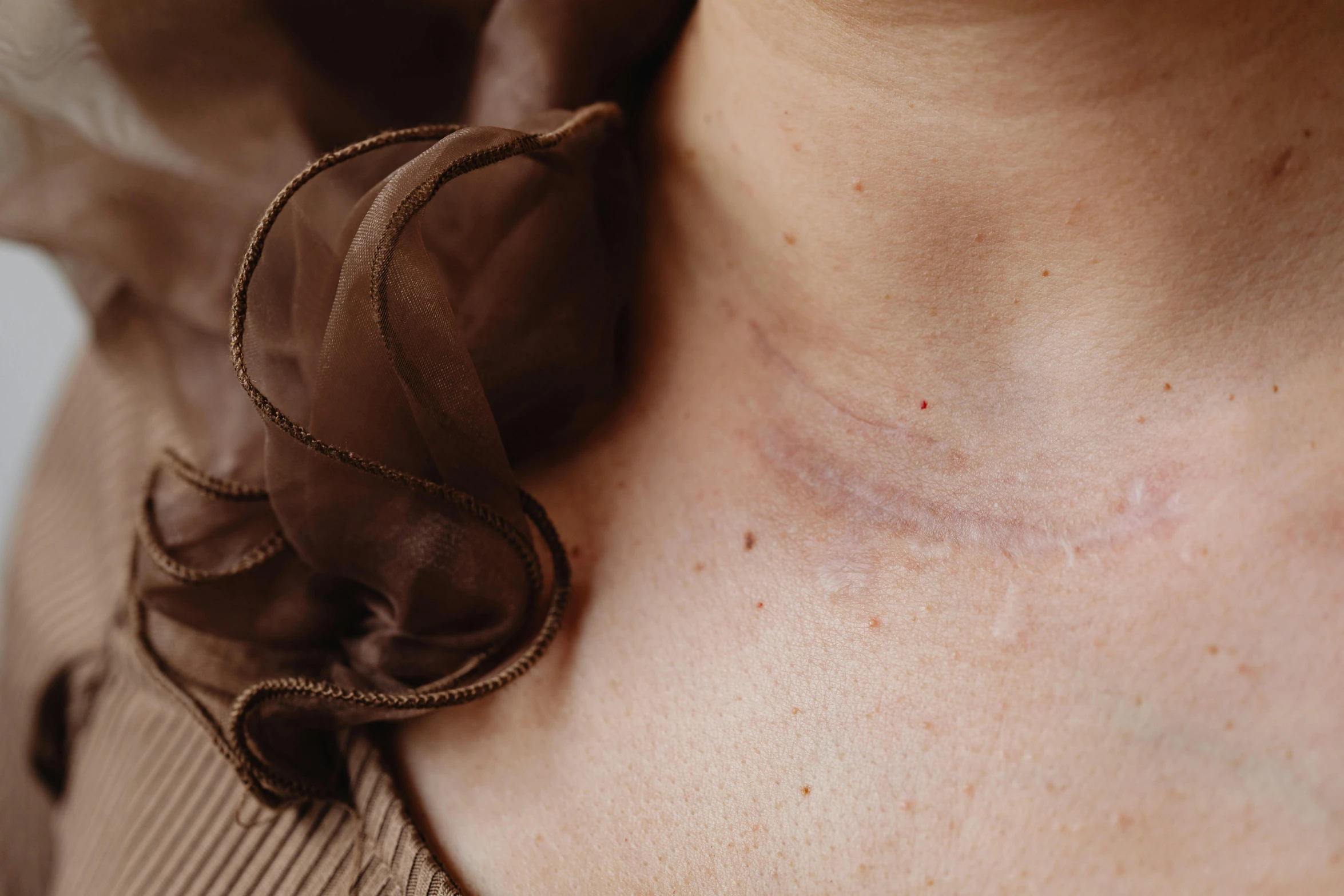 a woman with a large spot of a small piece of string on her chest