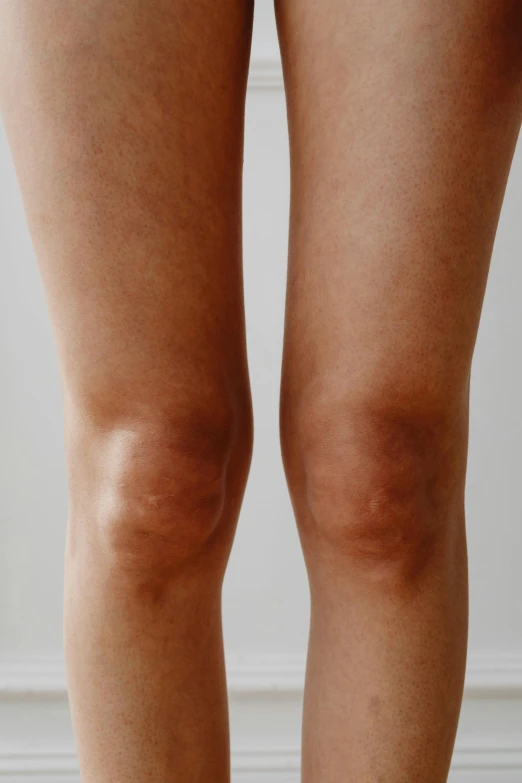 a person with knee shins showing 