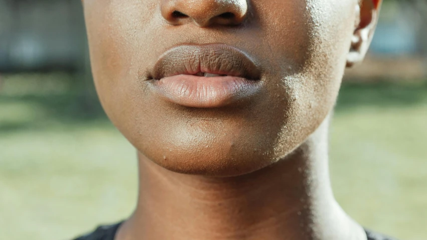 woman with a sunburnt on her face outside