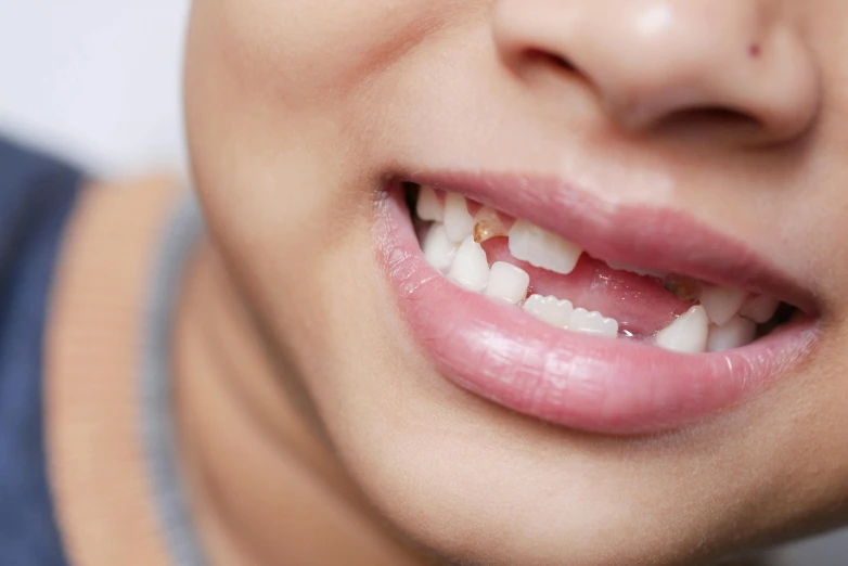 closeup of childs teeth with dental floss on them